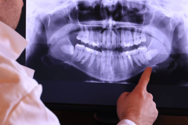 Best Emergency Treatment for Dental Infections or Abscesses in Borrego Springs, CA