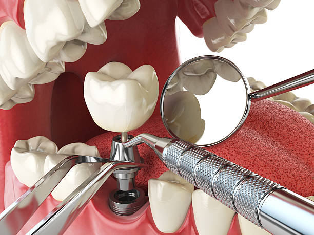Best Weekend Emergency Dentist in Borrego Springs, CA